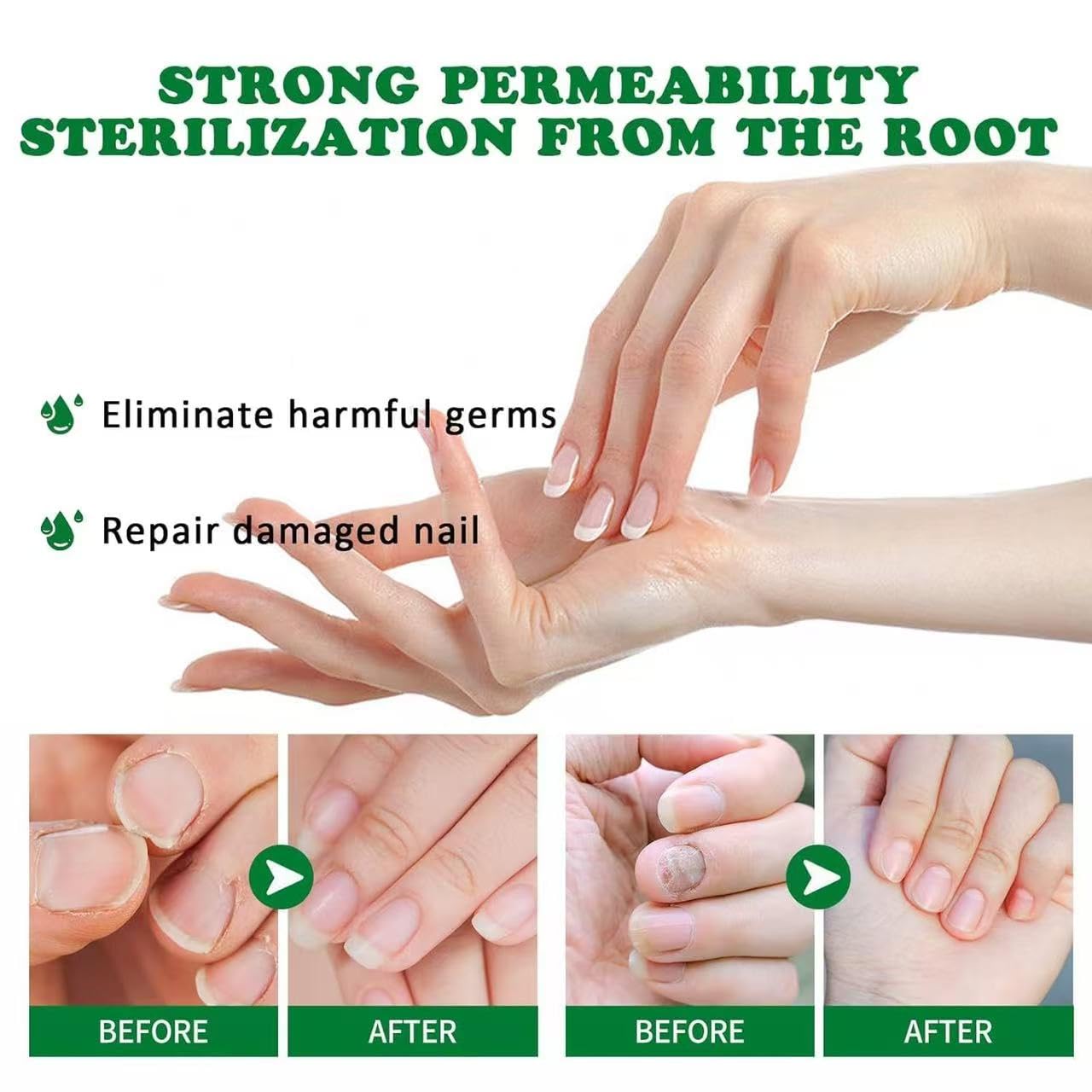Lmoy Nail Repair Gel application on nails demonstrates smooth coating for moisture.
