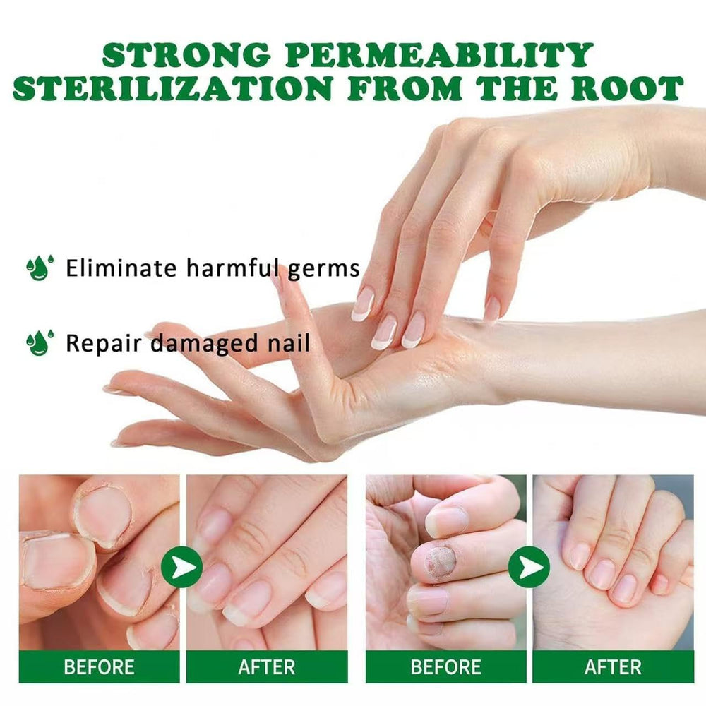 Lmoy Nail Repair Gel application on nails demonstrates smooth coating for moisture.