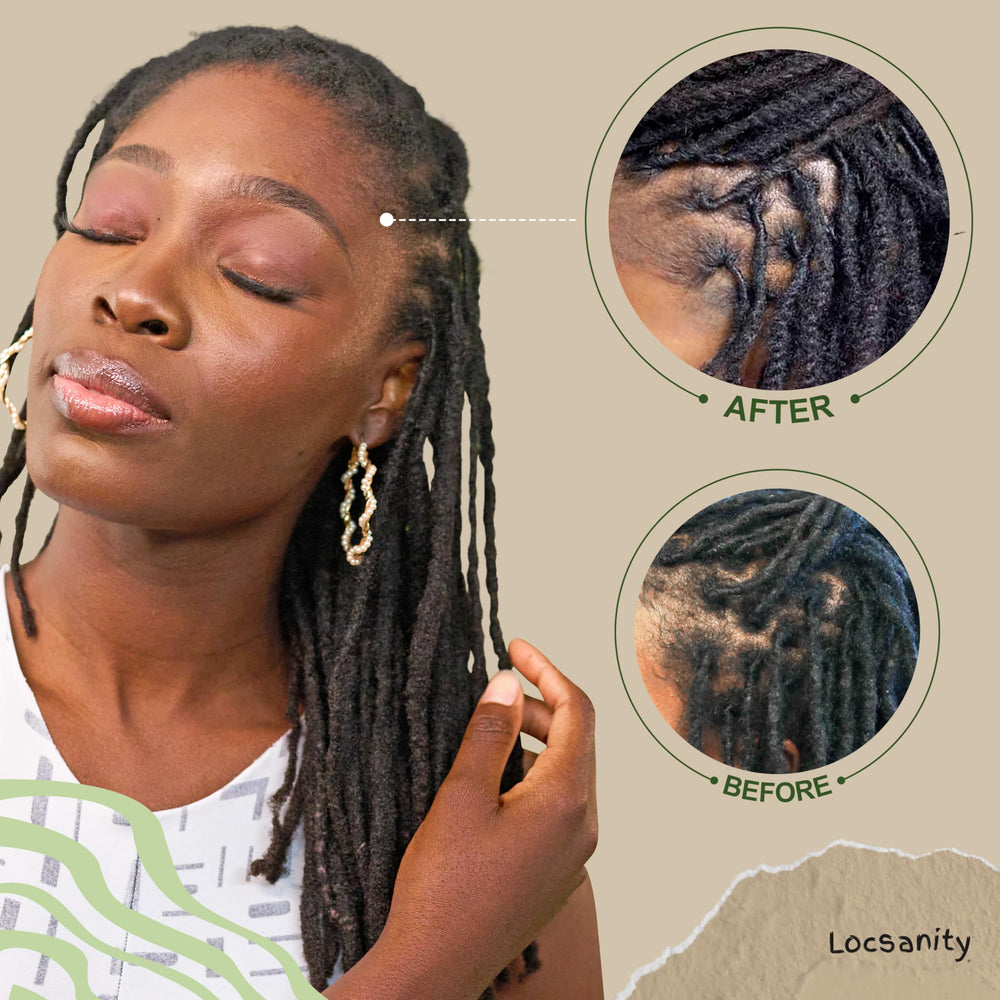 Locsanity tool kit for dreadlocks arranged for clean parts and neat sections.