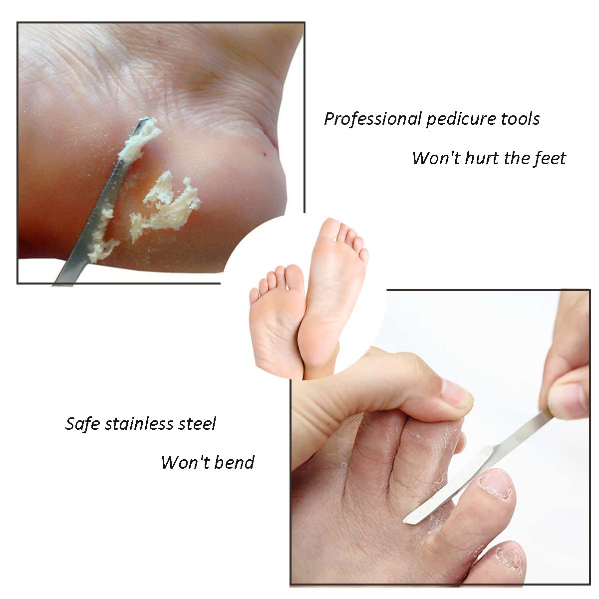 LOPURO foot-scraper-knife-stainless-steel enables safe dead-skin maintenance at home.