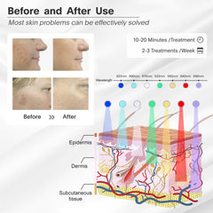 LOUDYKACA seven-color LED panel demonstrates multi-mode options for versatile skin care.