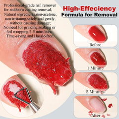 Louinstic nail latex barrier application around nails protects skin.