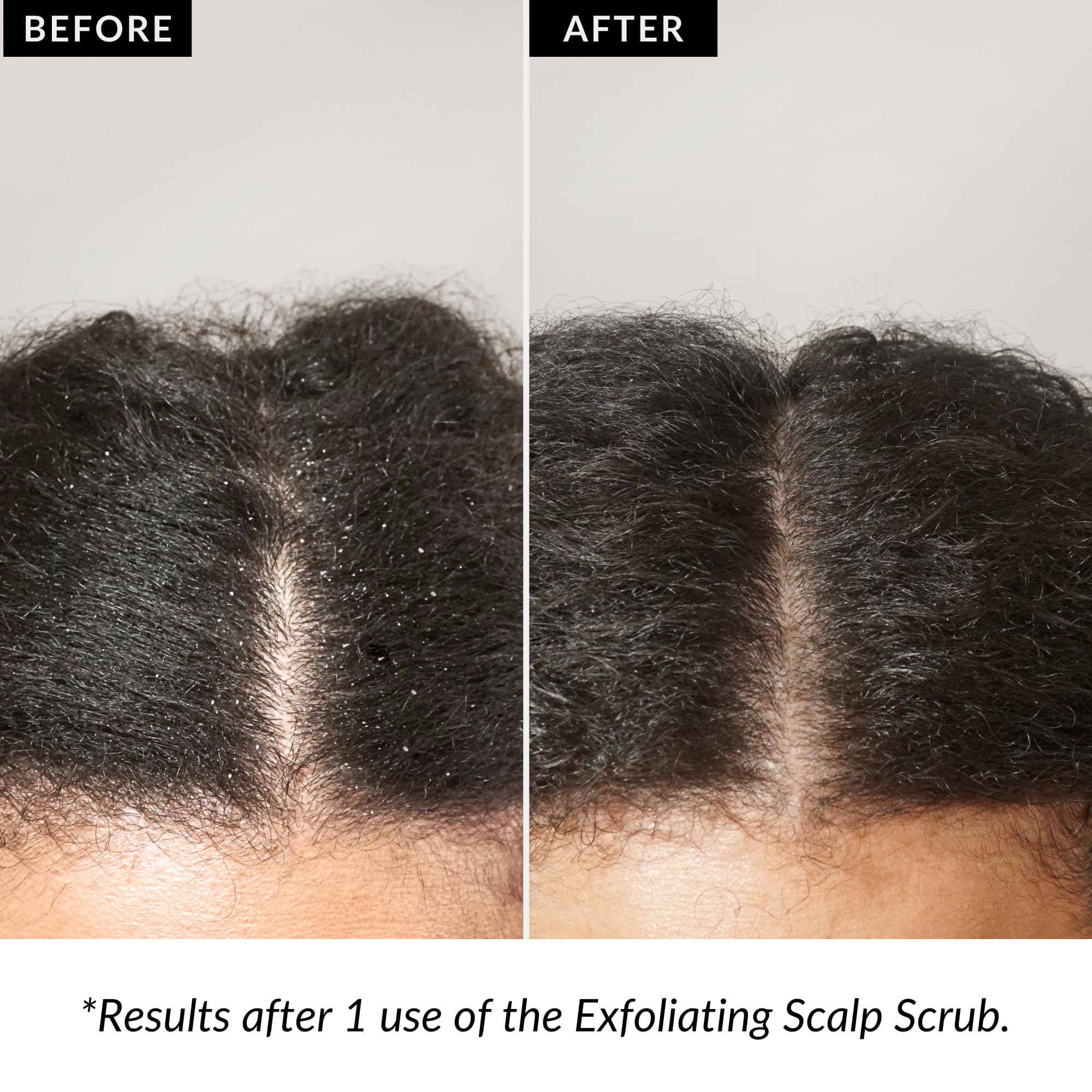 Love Ur Curls Exfoliating Scalp Scrub exotic botanicals supporting healthy scalp environment.