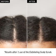Love Ur Curls Exfoliating Scalp Scrub exotic botanicals supporting healthy scalp environment.