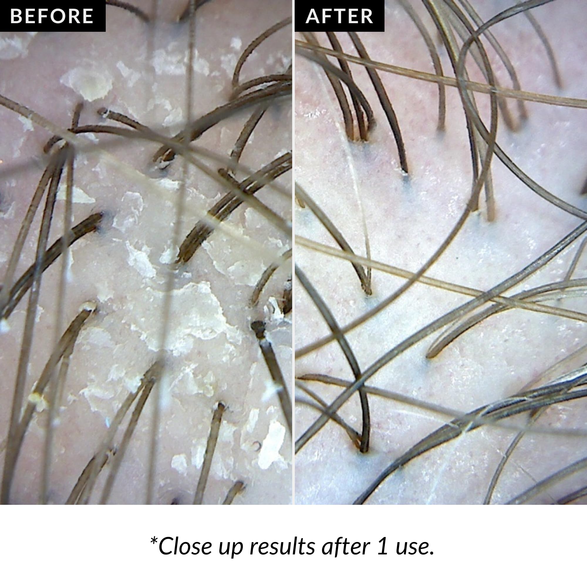 Love Ur Curls Exfoliating Scalp Scrub volcanic ash texture for gentle exfoliation.