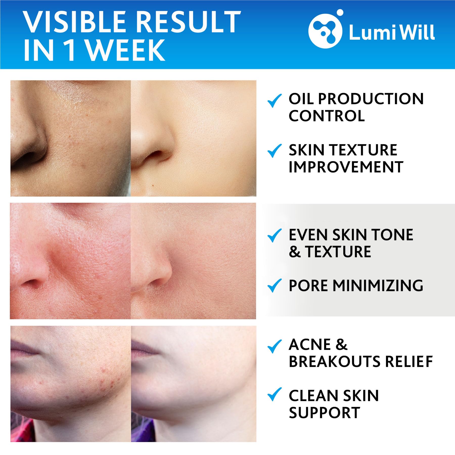 LumiWill pad infused with vitamins C and E for brightening and protection