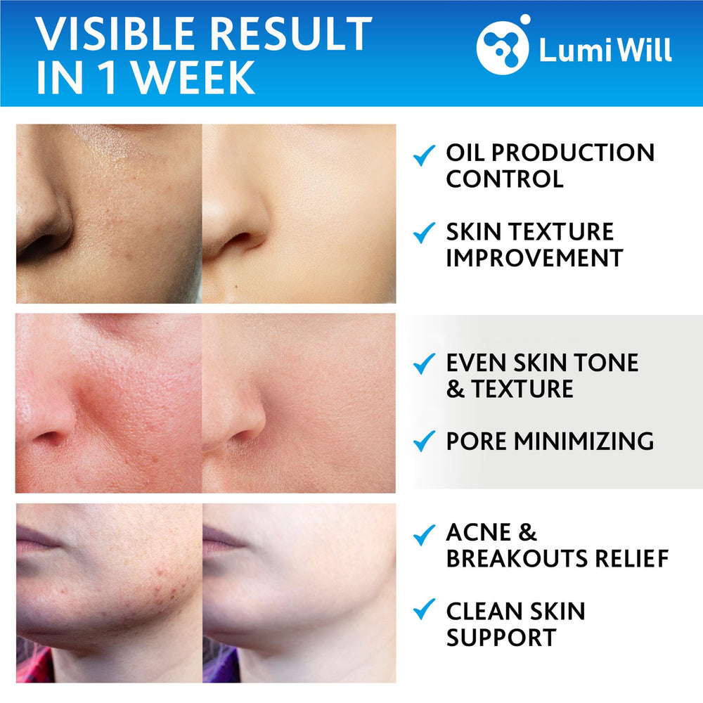 LumiWill pad infused with vitamins C and E for brightening and protection