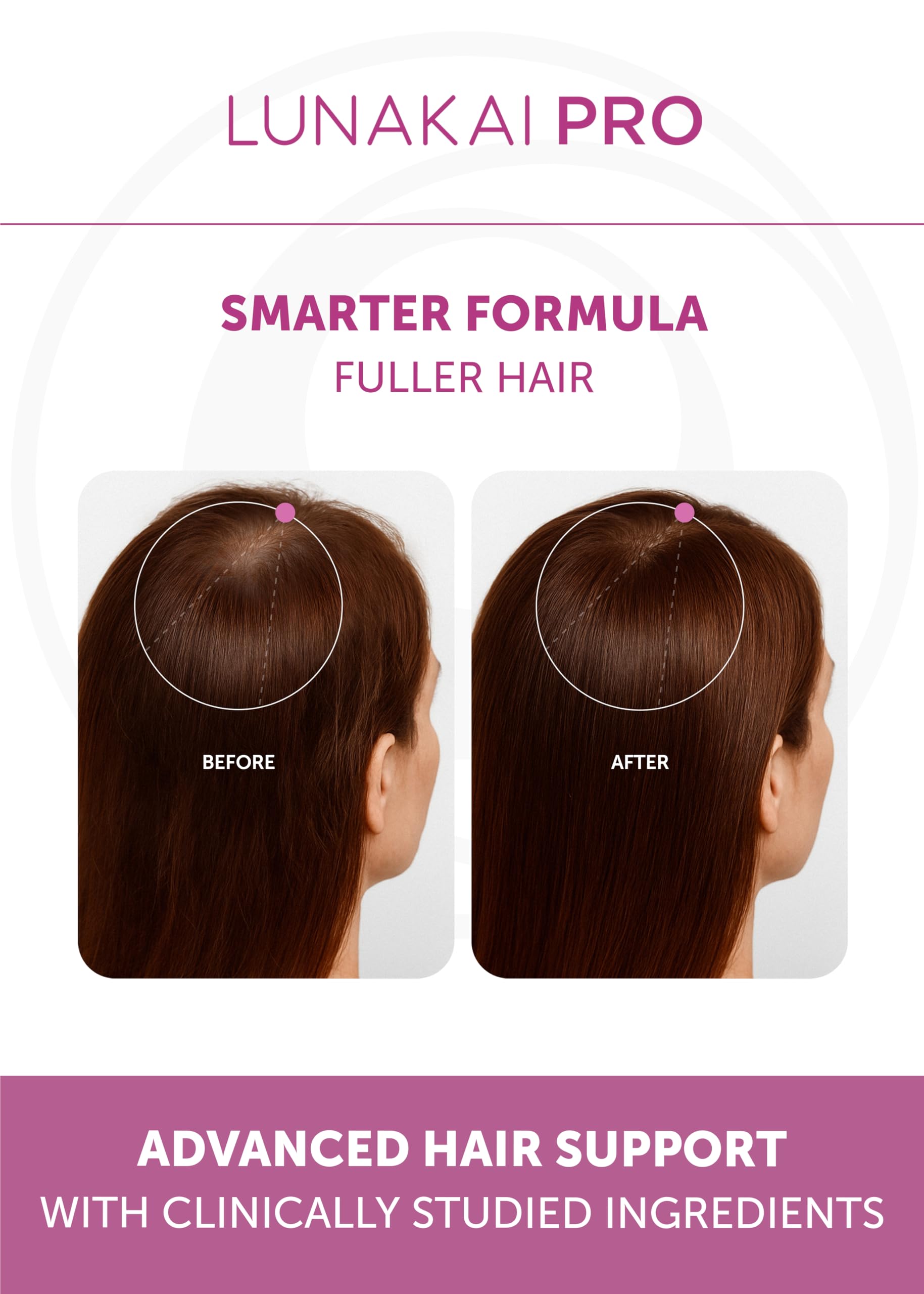 Lunakai PRO hair strand close-up reveals nourished follicles and thicker appearance.