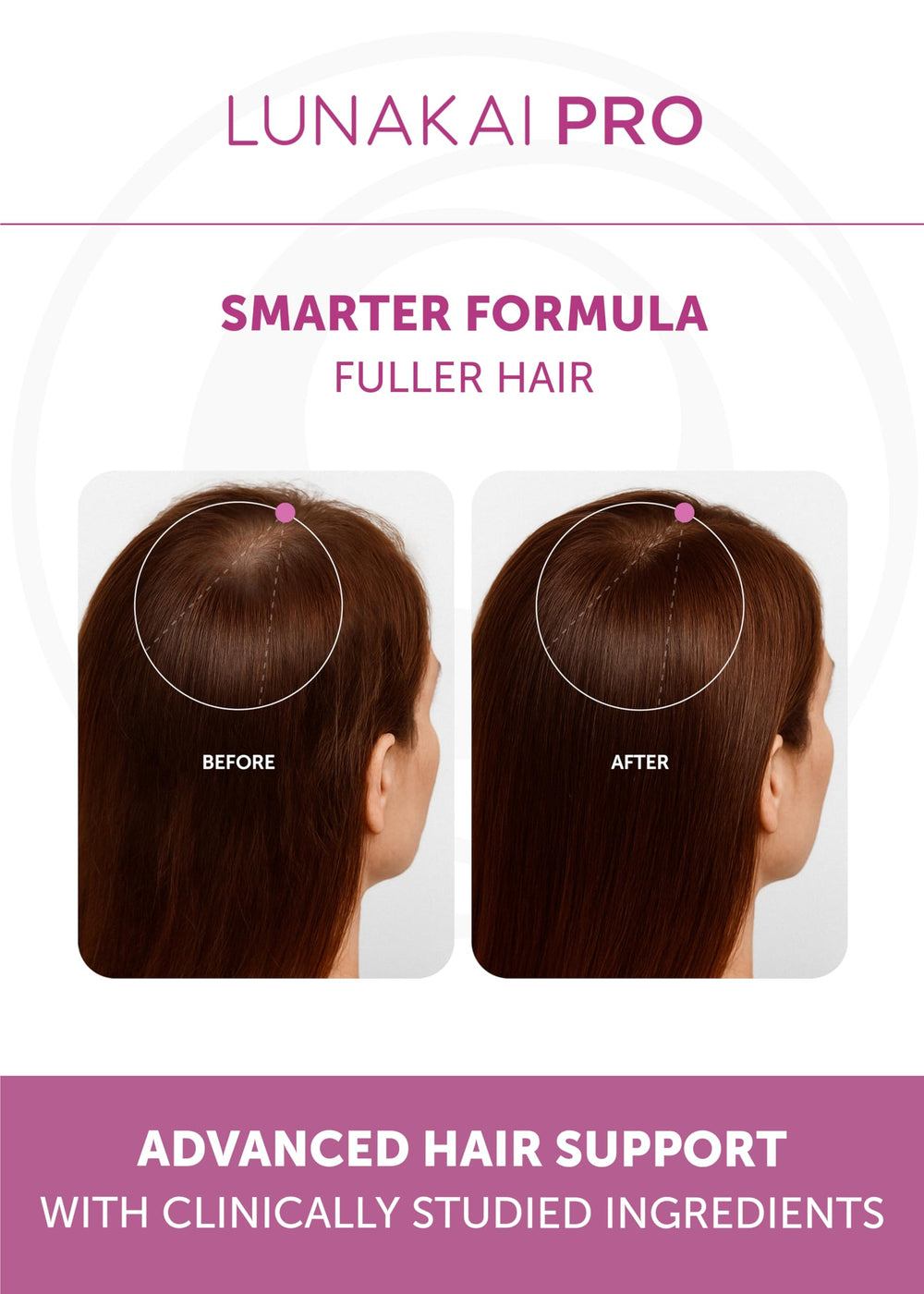 Lunakai PRO hair strand close-up reveals nourished follicles and thicker appearance.