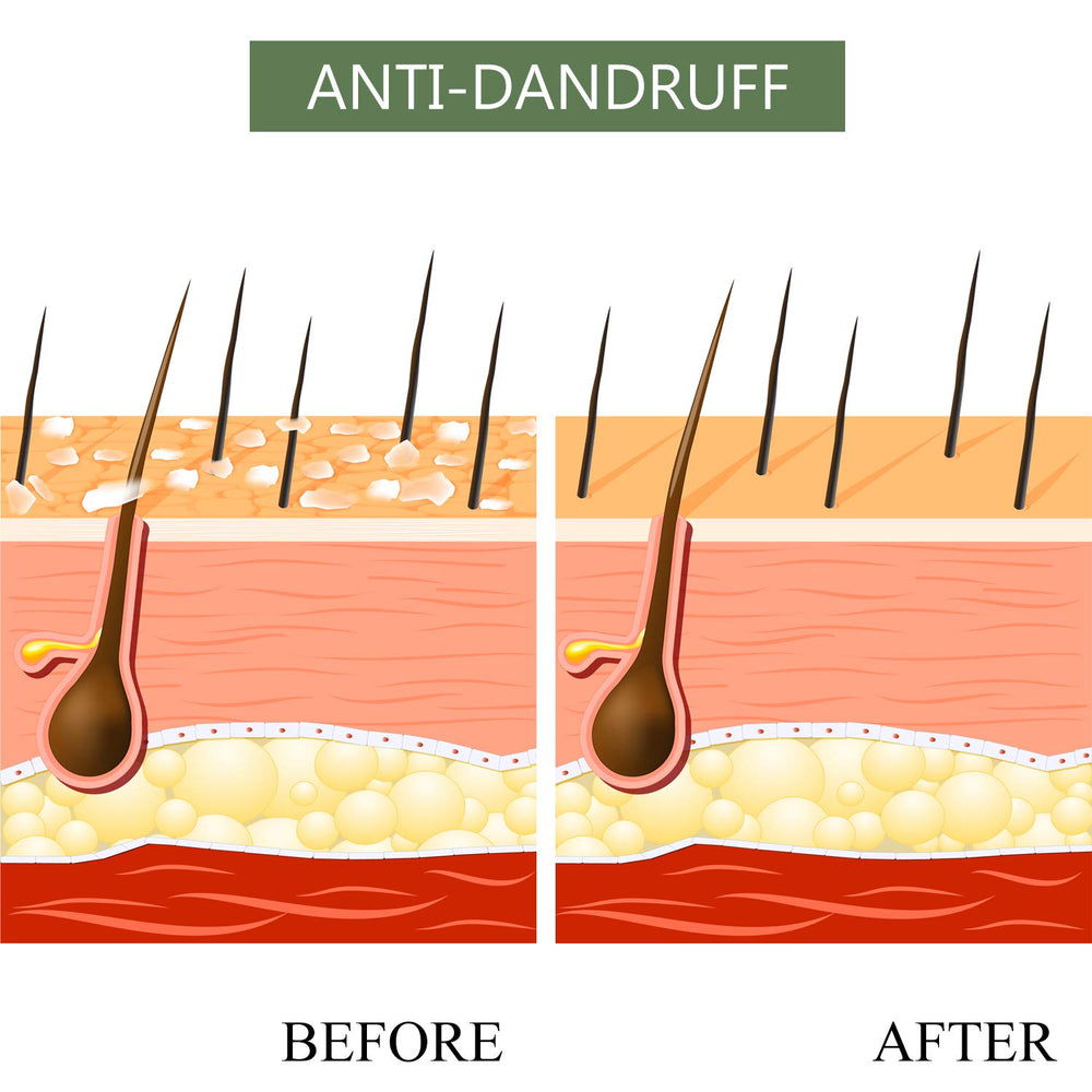 Luseta Tea Tree & Argan Oil detangling set packaging highlights sulfate-free, cruelty-free formula