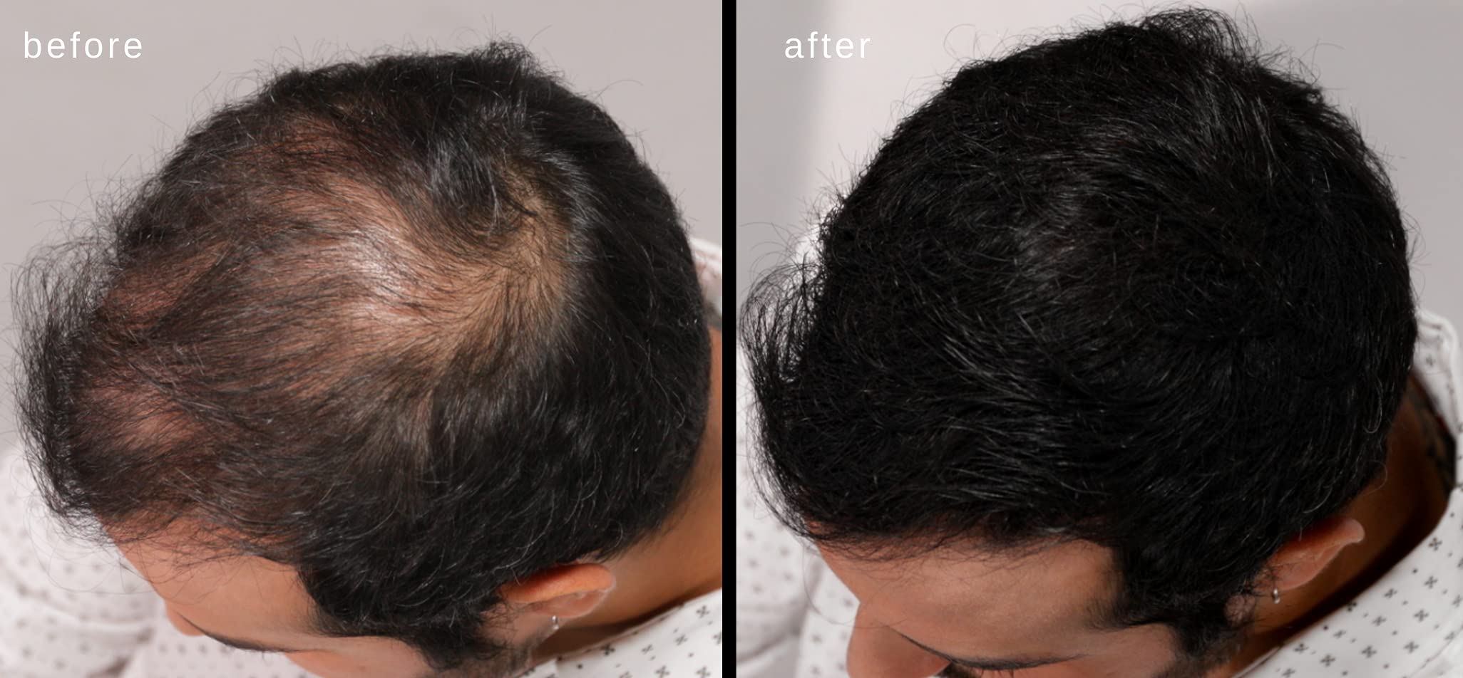 LUXE Hair Building Fibers Dark Brown shade applied naturally.