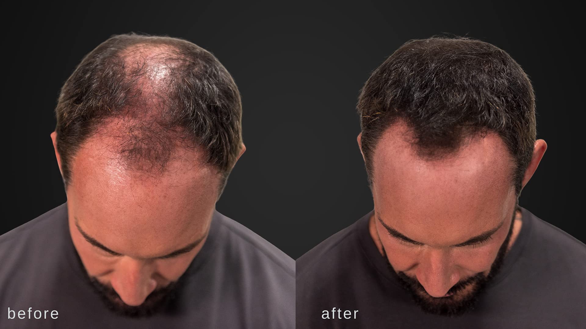 LUXE Hair Building Fibers dry-application scene for quick coverage.