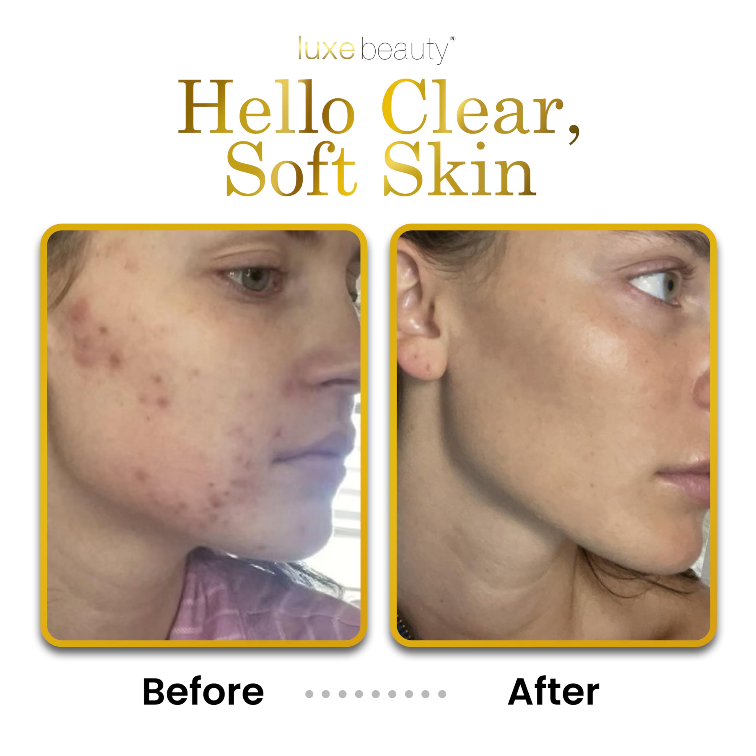 LUXEBEAUTY LuxeLotion vitamin B3 supports even tone and resilience