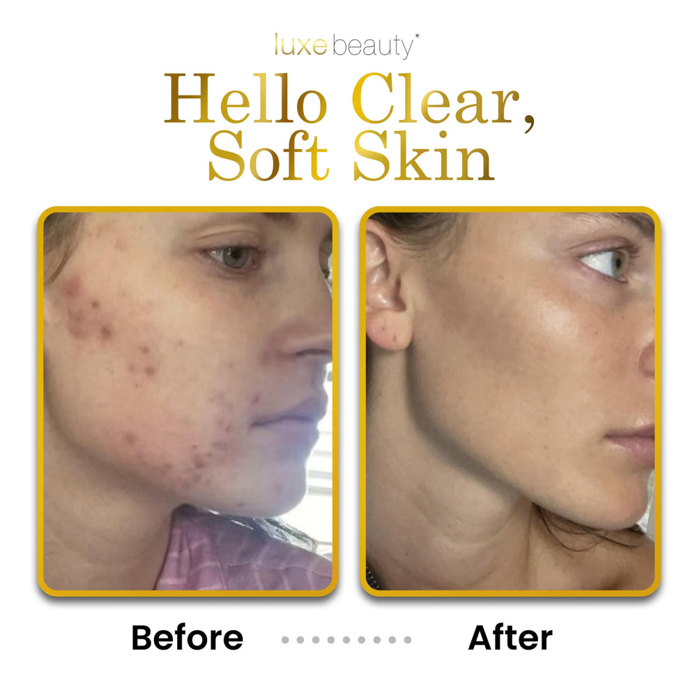 LUXEBEAUTY LuxeLotion vitamin B3 supports even tone and resilience