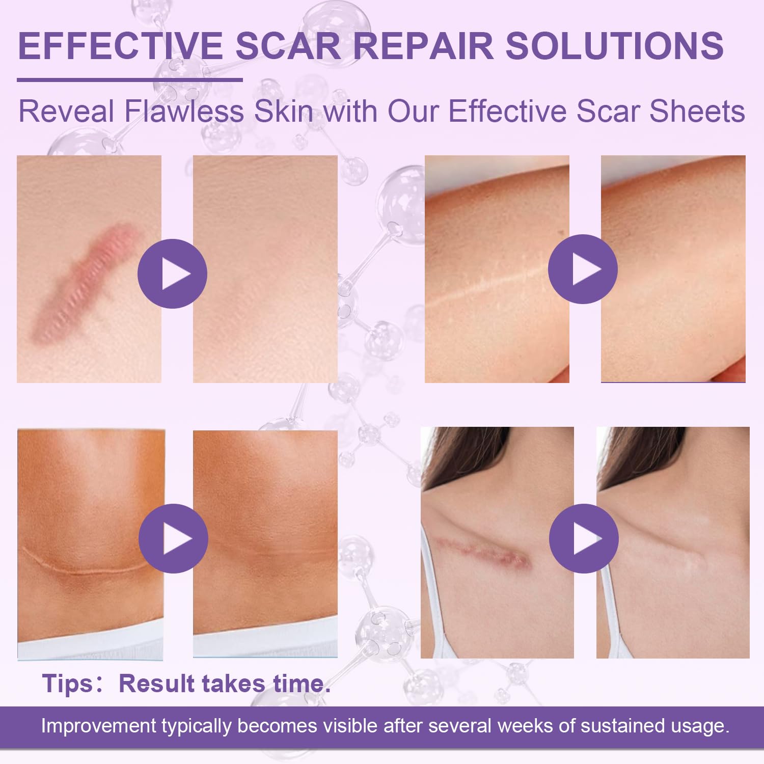 LUXEFUS silicone scar softening hydration illustrates hydration helping soften scar tissue over time