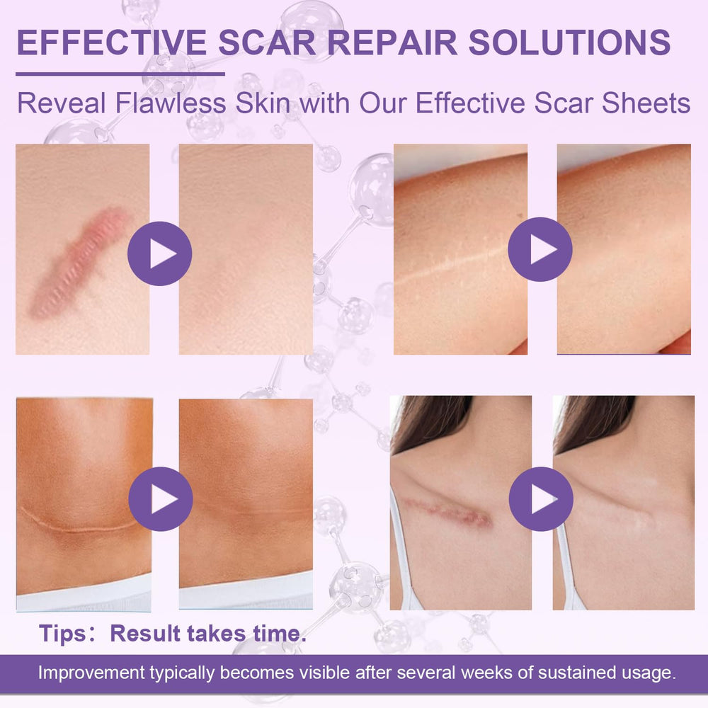 LUXEFUS silicone scar softening hydration illustrates hydration helping soften scar tissue over time