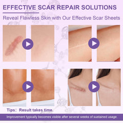 LUXEFUS silicone scar softening hydration illustrates hydration helping soften scar tissue over time