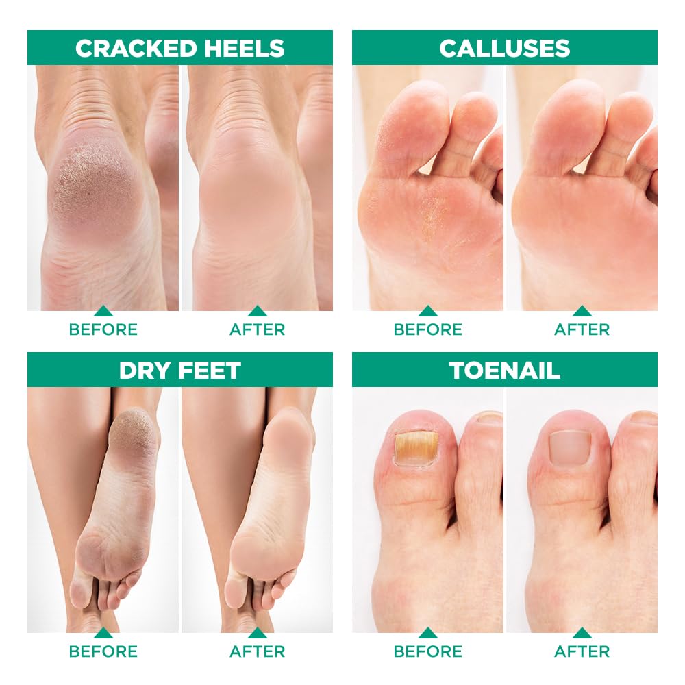 LV LAVINSO foot care routine soak