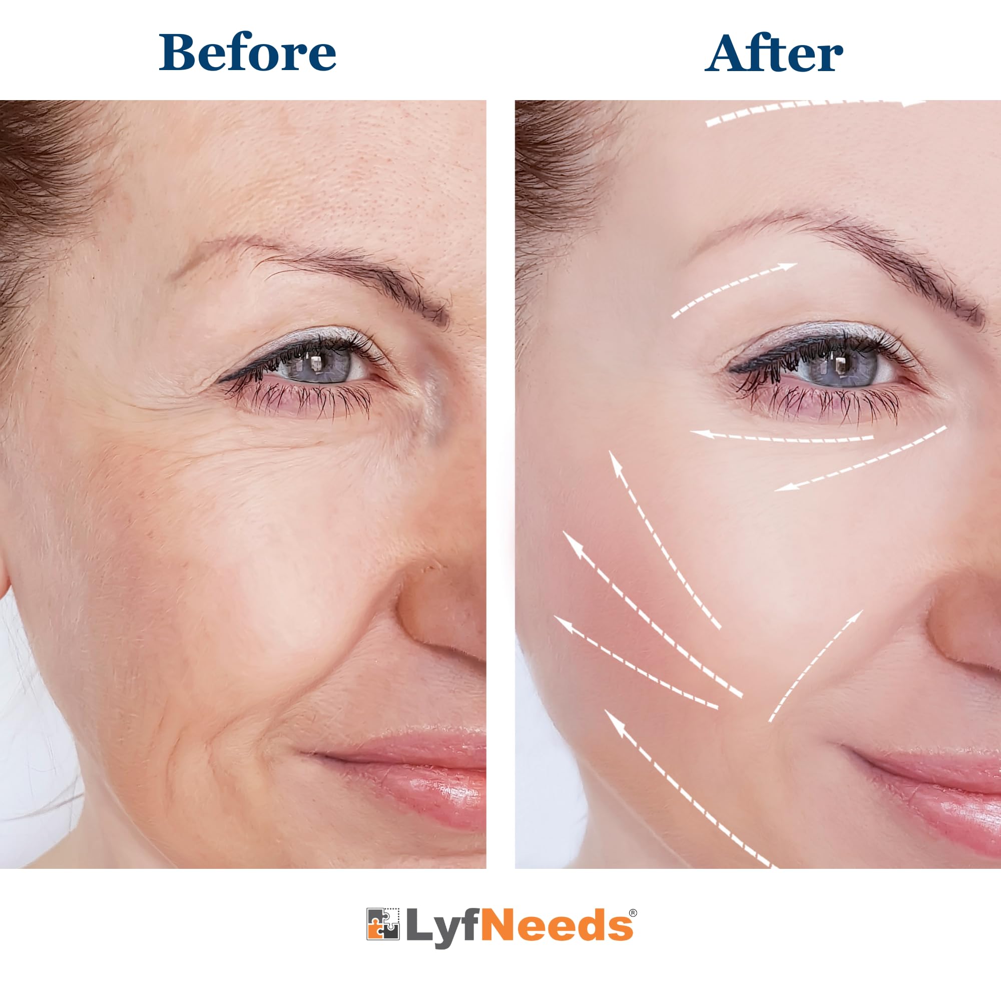 LyfNeeds ice-mold DIY green tea recipe enhances soothing, antioxidant-inspired care.