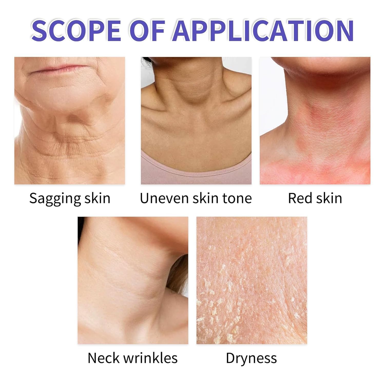 lymznus-neck-before-after-pack shows visible smoothing after consistent use