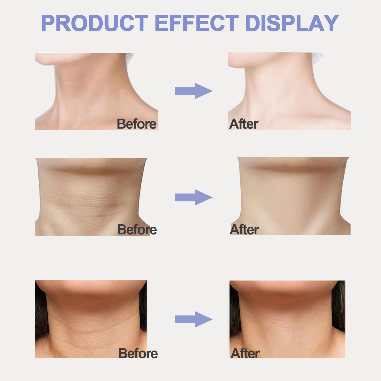lymznus neck-tightening-cream-closeup highlights light absorption and hydration