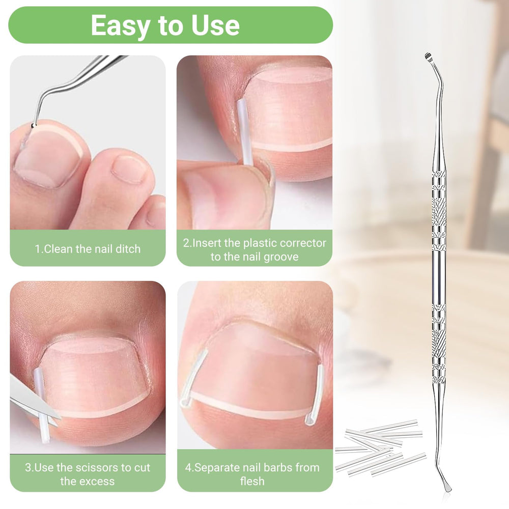 LYNRUI lifter tools set aiding nail edge lifting and alignment