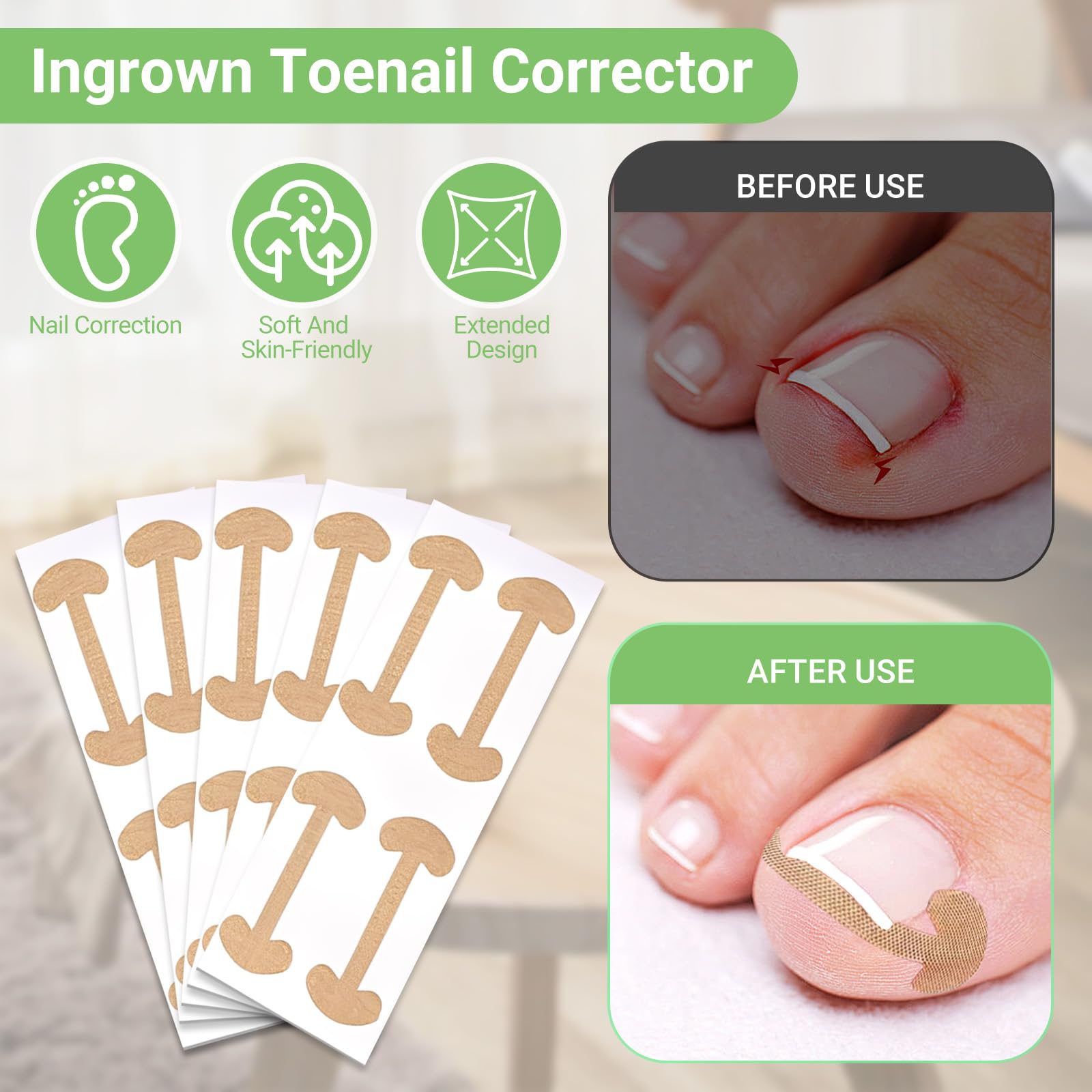 LYNRUI nail file for smoothing edges and better patch adhesion