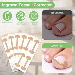 LYNRUI nail file for smoothing edges and better patch adhesion