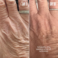 MAELYs B-GLOSSY application scene demonstrates massage into arms for smoother skin.