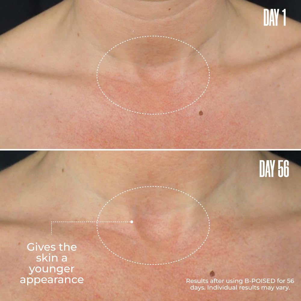 MAËLYS B-POISED pink pepperslim plant extract supports smoother look in the decolletage