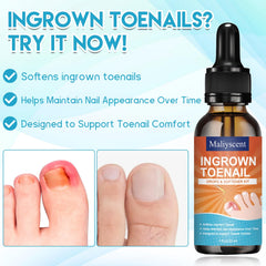 Maliyscent ingrown toenail clipper with ergonomic handle for precise trimming