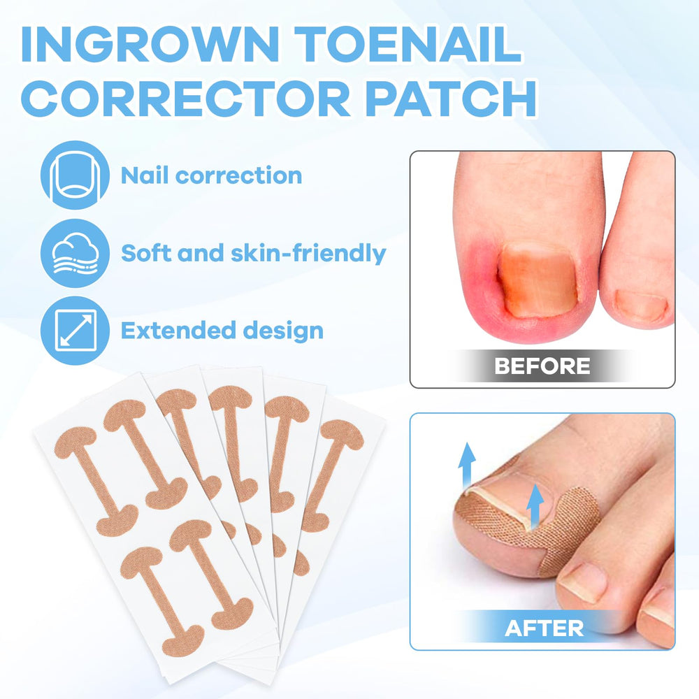 Maliyscent curved-toenail-patch applied to nail edge to ease pressure