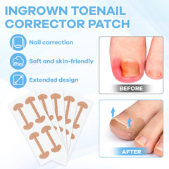 Maliyscent curved-toenail-patch applied to nail edge to ease pressure