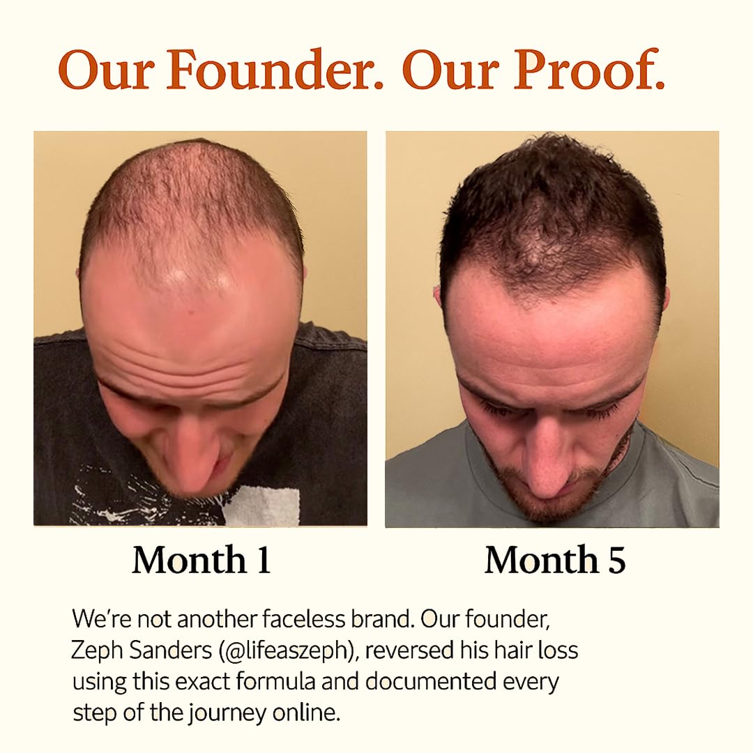 Mane Elixir dropper pour captures precise application for targeted scalp nourishment.