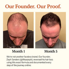 Mane Elixir dropper pour captures precise application for targeted scalp nourishment.