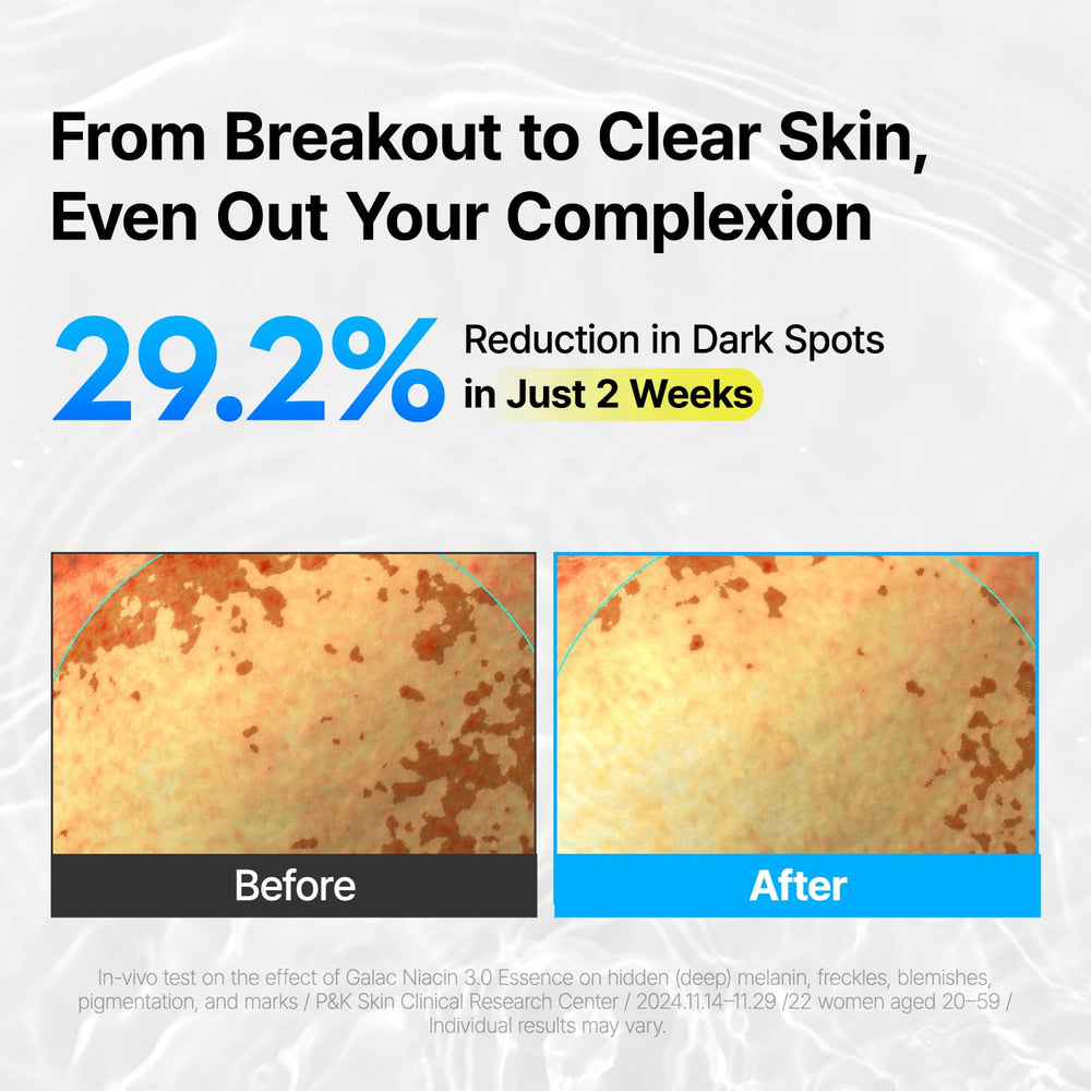 MANYO Galac Niacin 3.0 Essence routine image suggests daily use