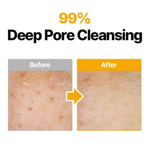 MANYO Pure Cleansing Oil removes waterproof sunscreen with a gentle cleanse.