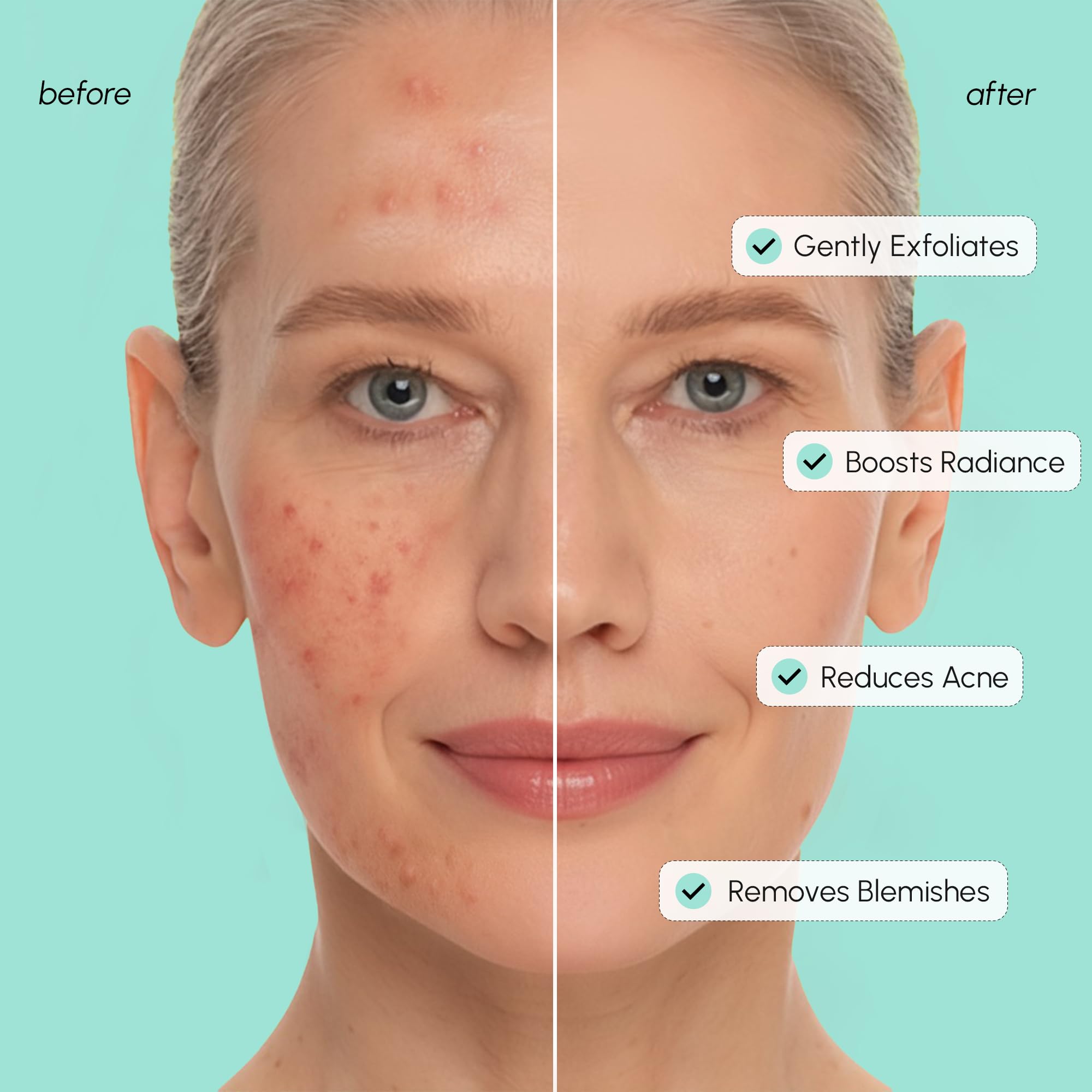 MAREE azelaic acid pads textured skin closeup hints at even tone