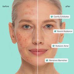 MAREE azelaic acid pads textured skin closeup hints at even tone