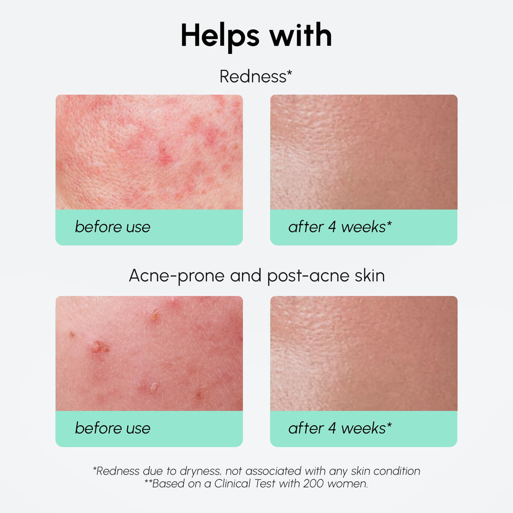 MAREE 10azelaic-serum-hyaluronic-drops emphasizes deep hydration support