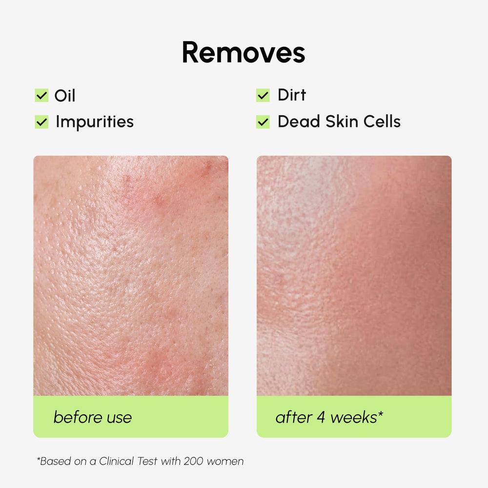 MAREE Exfoliating Toner 4-acid-complex shot hints balanced complexion