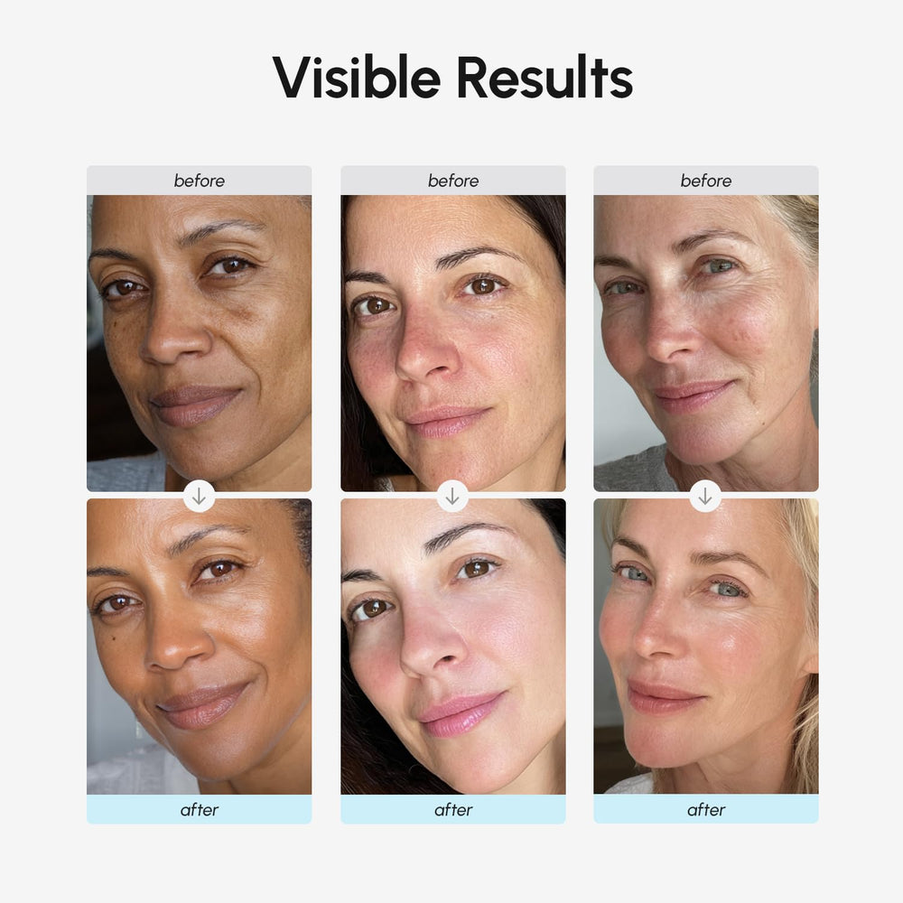 MAREE collagen hyaluronic acid ingredients label emphasizes skin hydration and renewal potential.