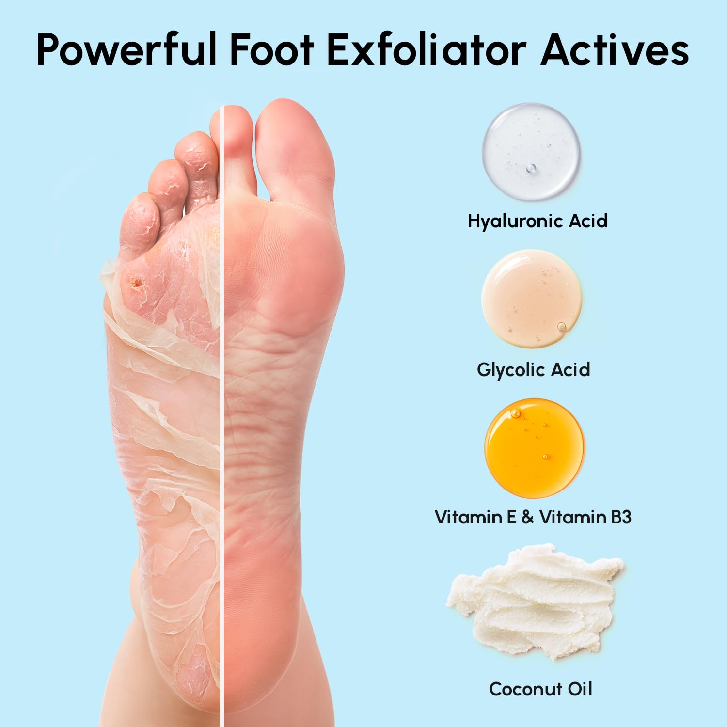 MAREE Foot Peeling Mask during renewal process shows softening of dry skin.