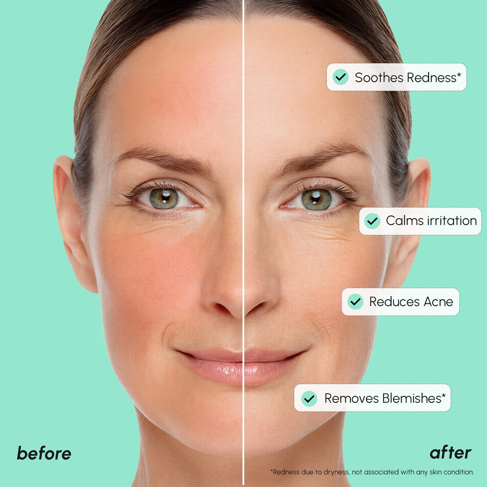 MAREE niacinamide-centella serum bottle suggests balanced, radiant-looking skin