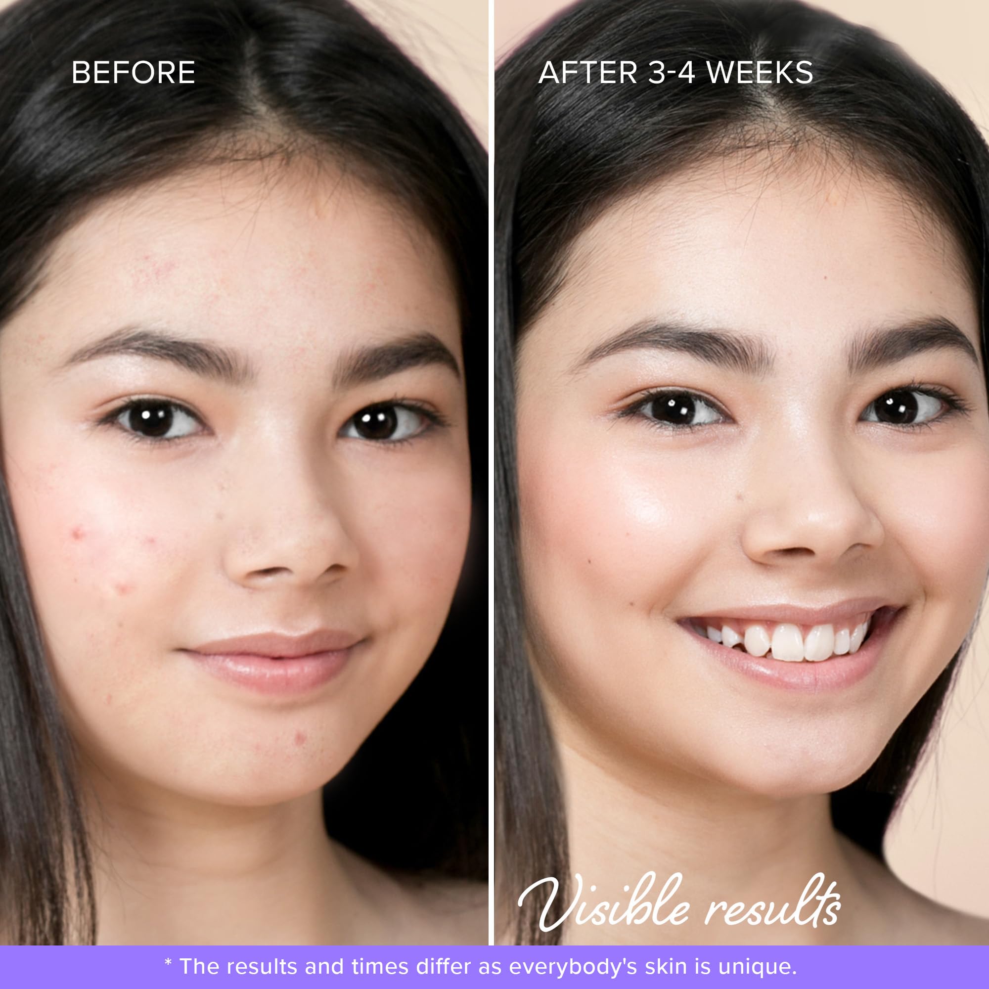 MAREE Star Pimple Patches are teen-friendly and ideal for school mornings.