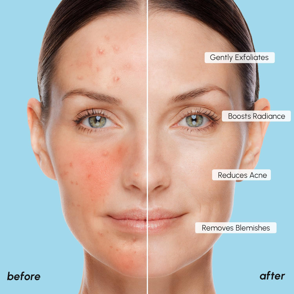 MAREE Glycolic Acid Pads Tea Tree Oil shot signals refreshing clarity and calming aroma.