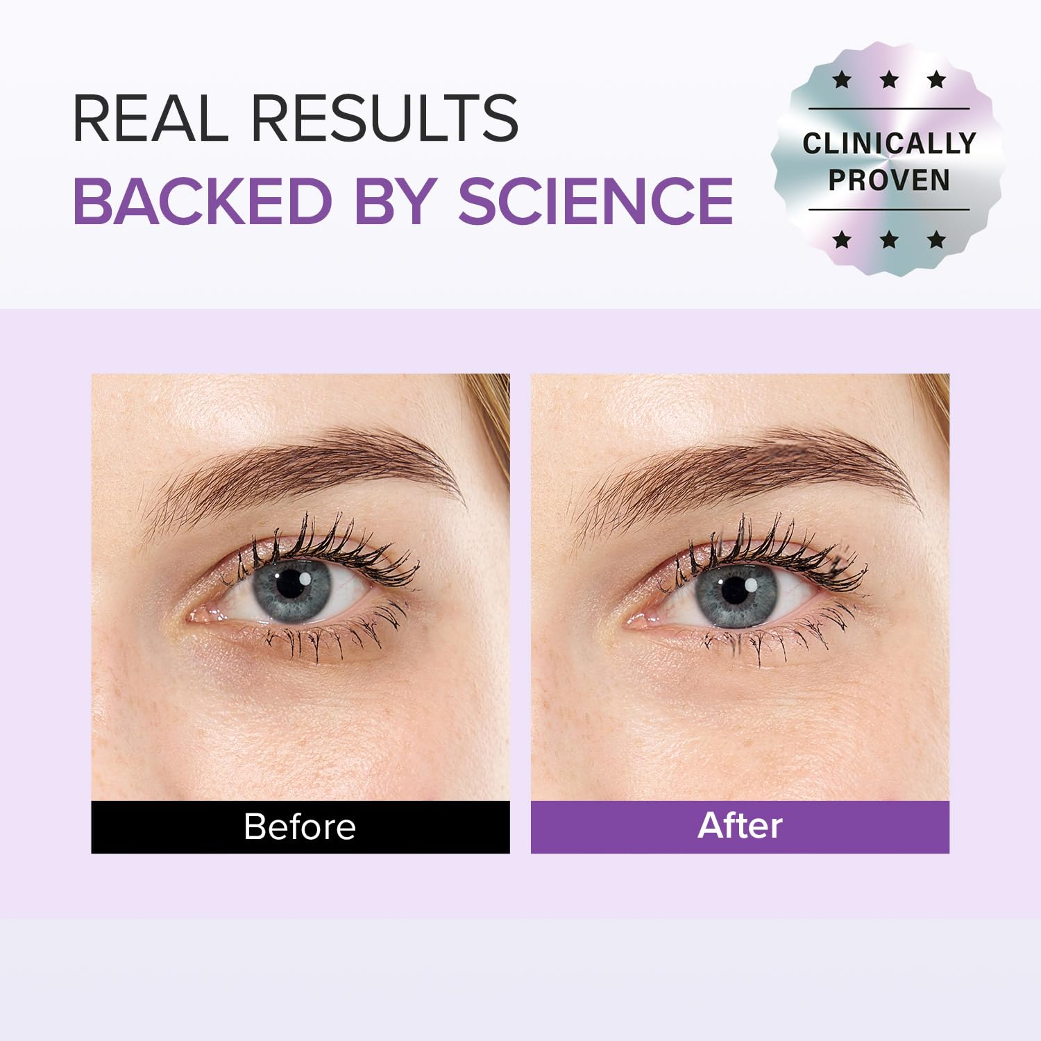 Mary&May Under-eye appearance before-after collage hints at dark circle improvements.