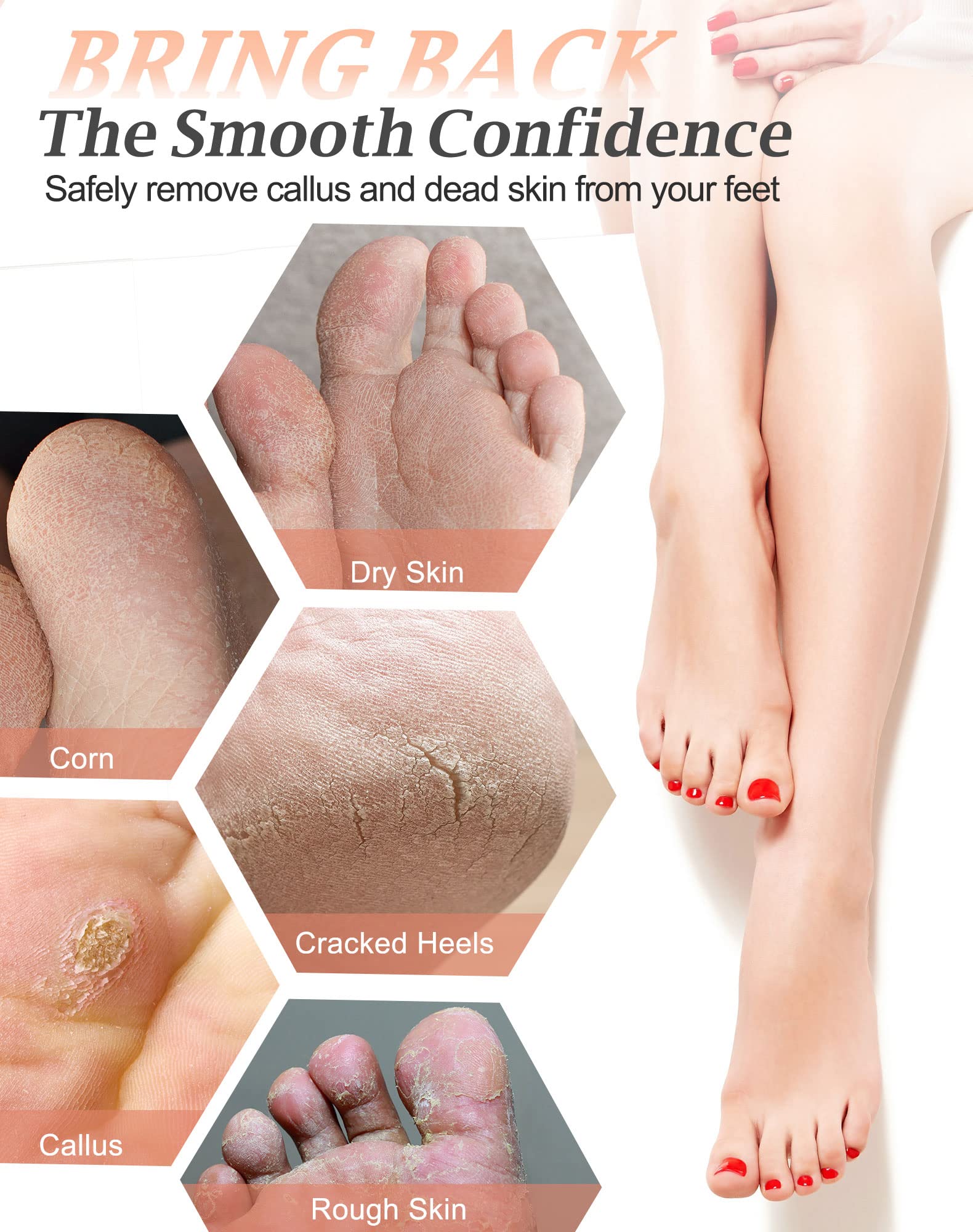 Maryton pumice stone callus remover visual highlights natural lava exfoliation.