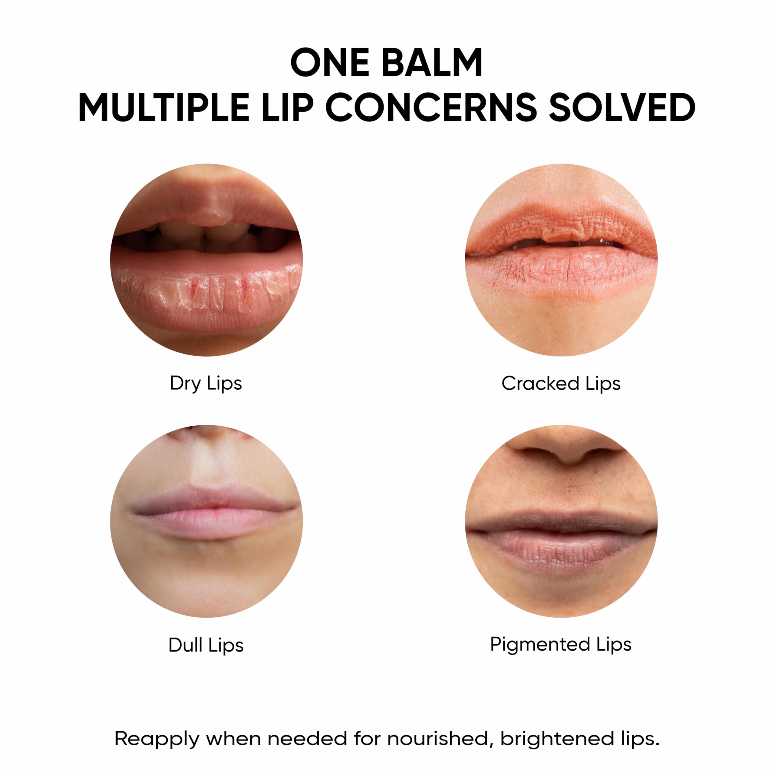 Masofta alpha-arbutin lip-tone close-up suggesting even pigmentation.