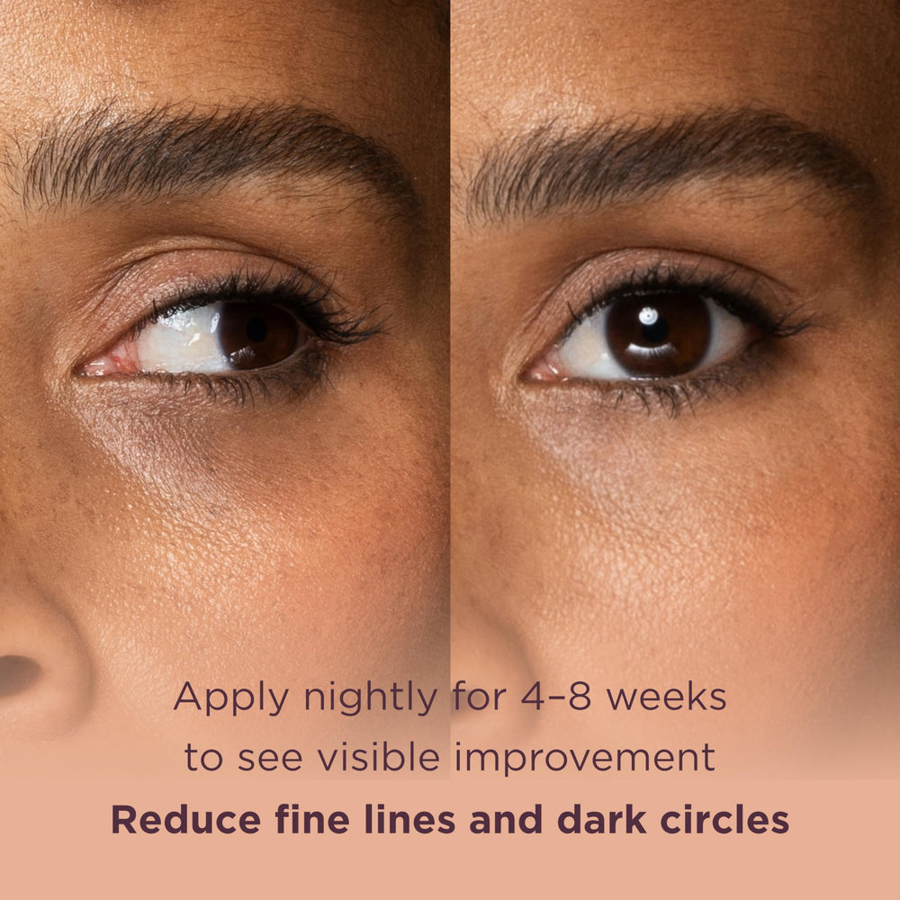 MATKAS Ceramides and Vitamin E supporting skin barrier repair